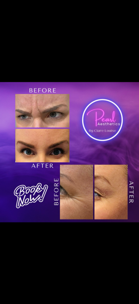 Anti-Wrinkle+Treatment