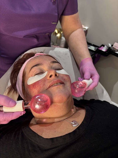 Facial%2FIce+Globe+Treatment+