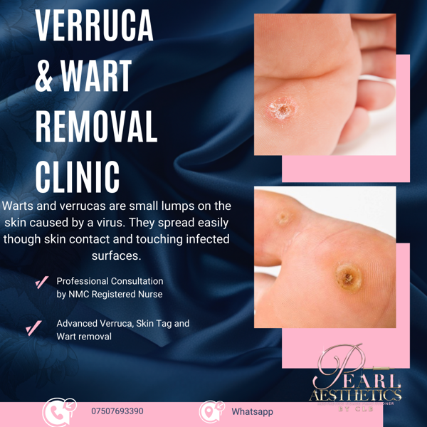 Verruca%2FSkin+Tag+Removal